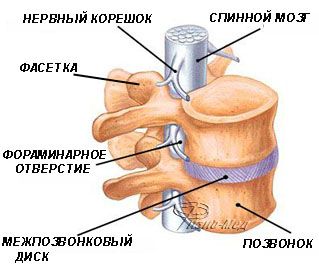 Спондилоартроз лечение